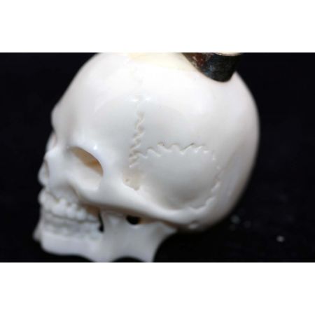 Knochenschädel-Anhänger